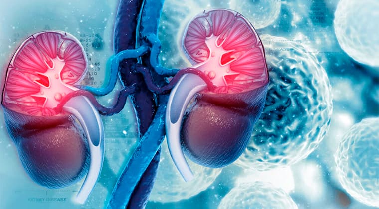 Cáncer renal