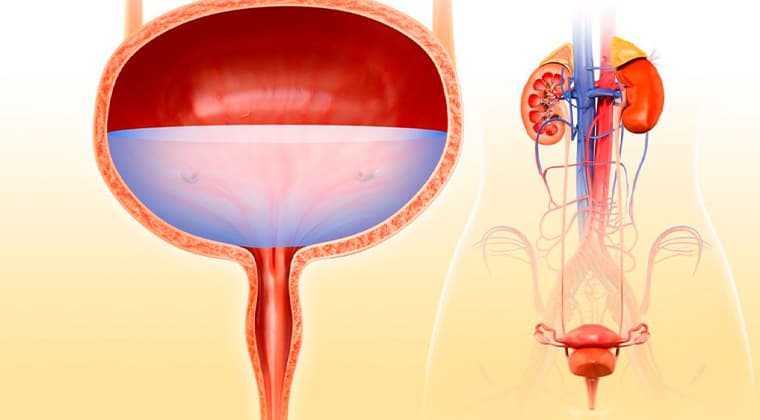 Vejiga hiperactiva